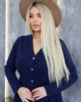 Къса рокля с копчета от Twiggy Shop, ярка и стилна, показана на модел, с кратка дължина и моден дизайн.